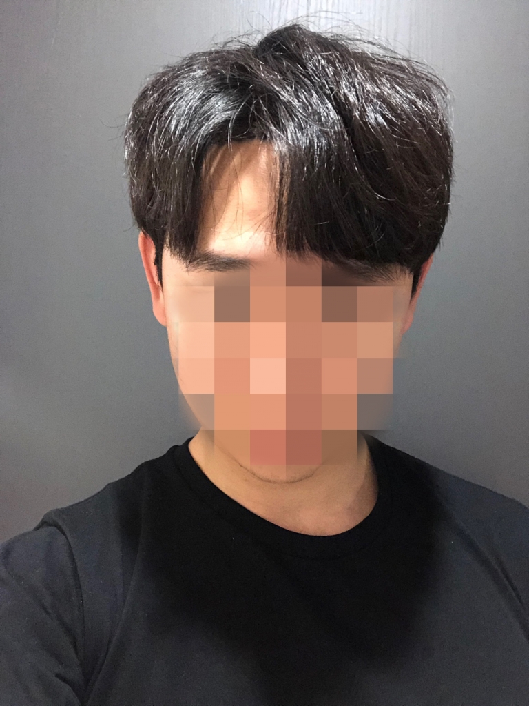 11.이대영_수술 일주일.jpg