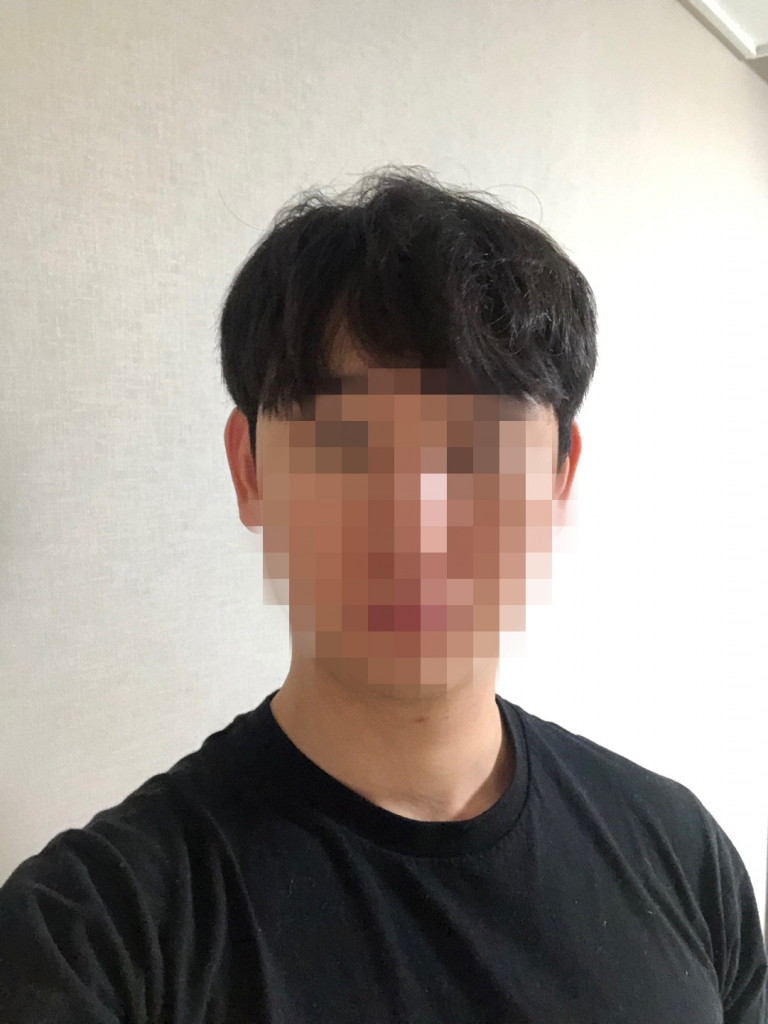 03.이대영_수술 1달.jpg