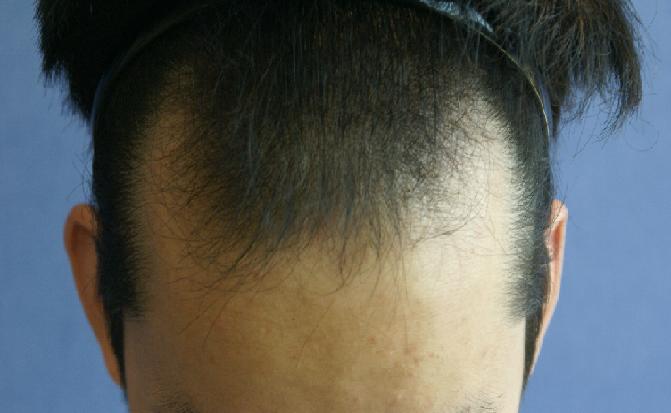 수술전.JPG