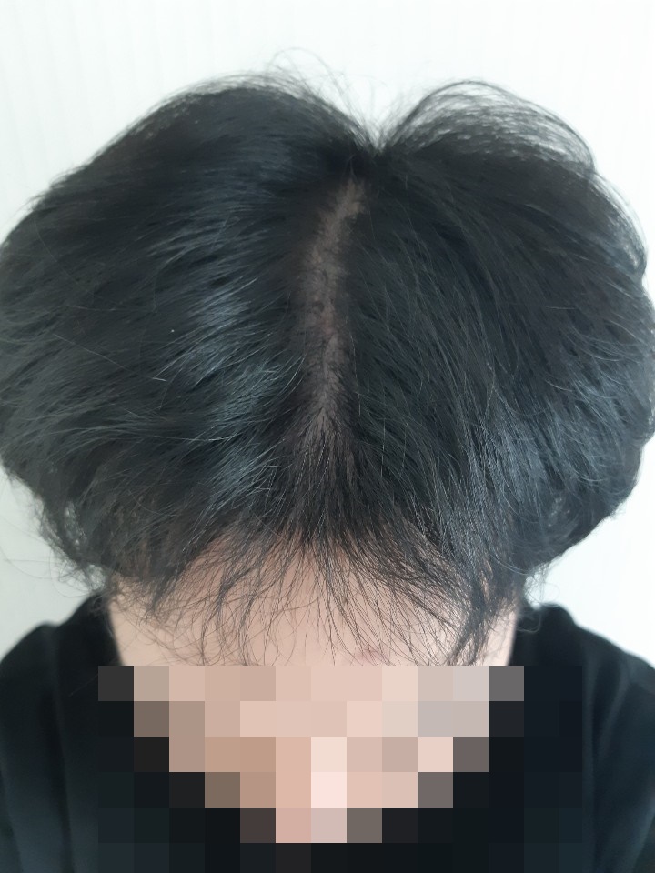 모자이크(2).jpg