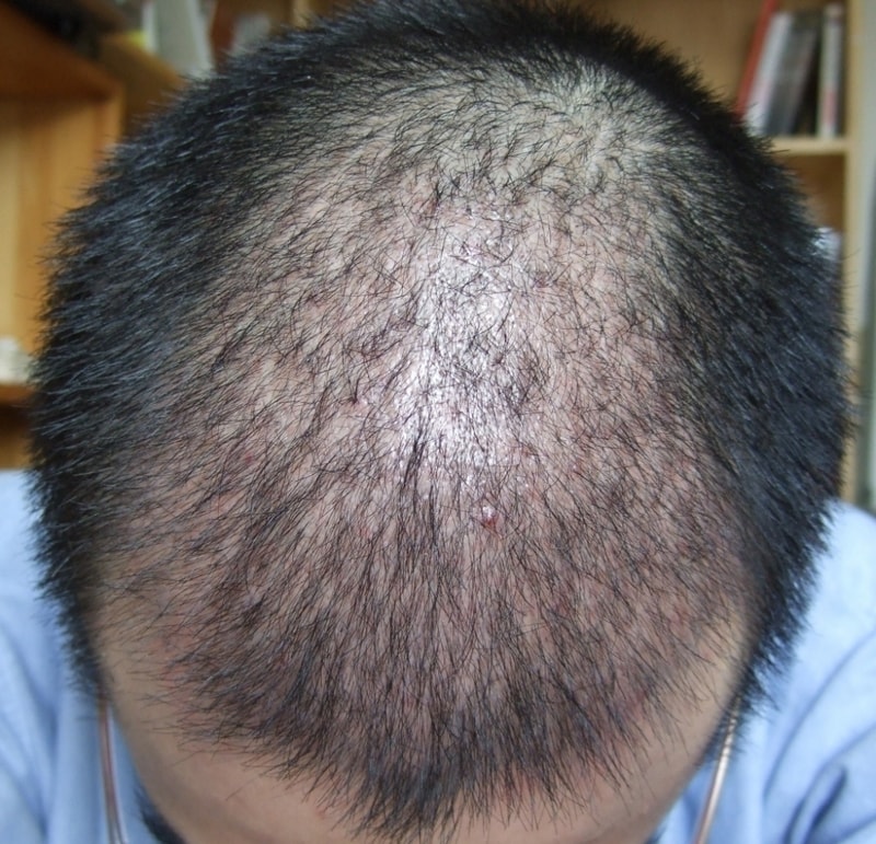 a1month - no flash.jpg