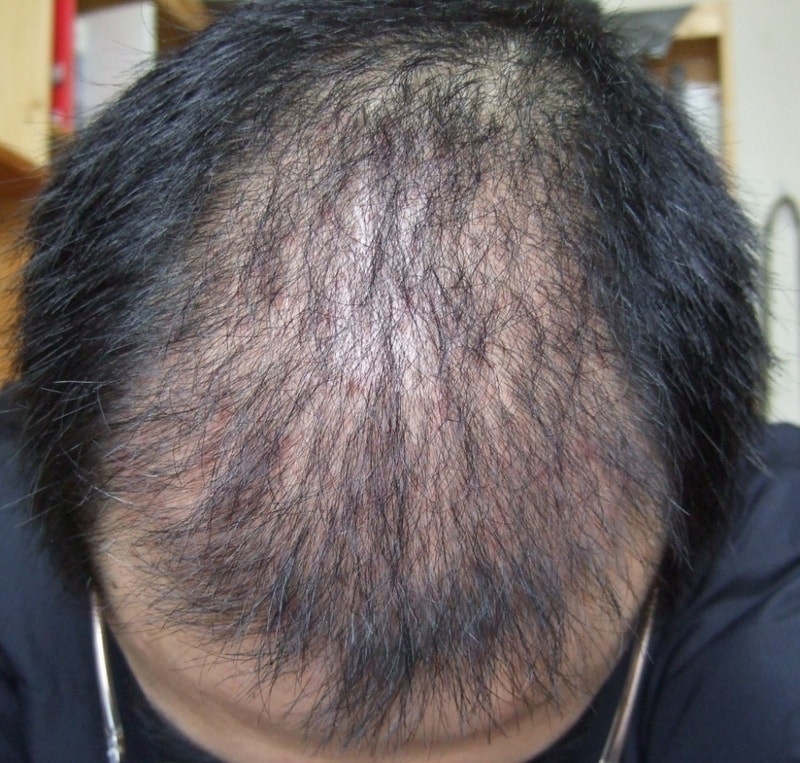 a2month - no flash.jpg