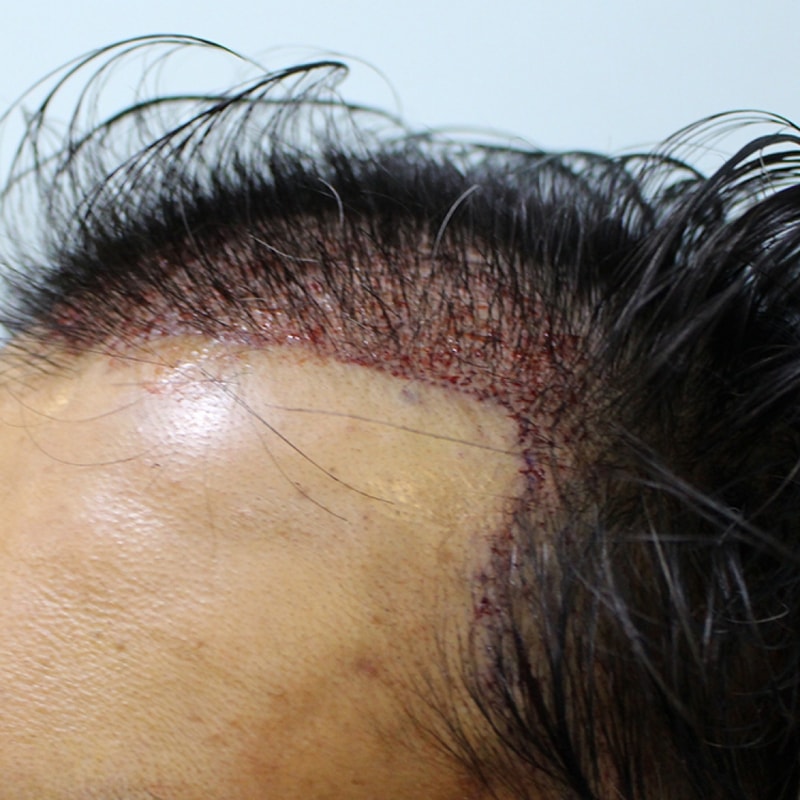 2 (1).JPG