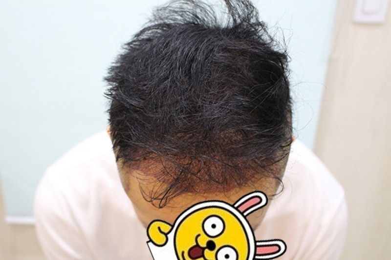 수술후 1일 (8).JPG
