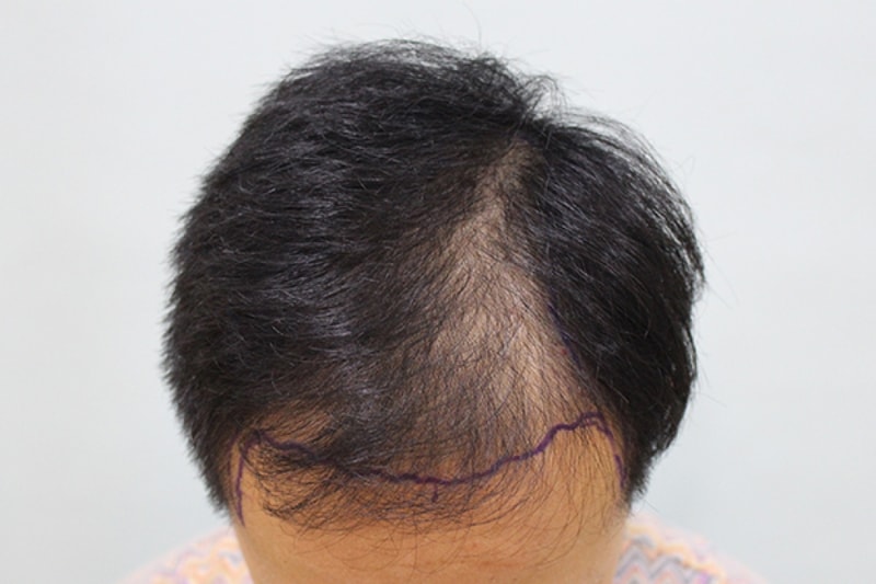 수술전디자인 (9).JPG