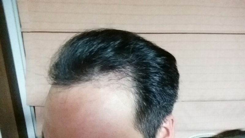 KakaoTalk_20160811_143819637.jpg