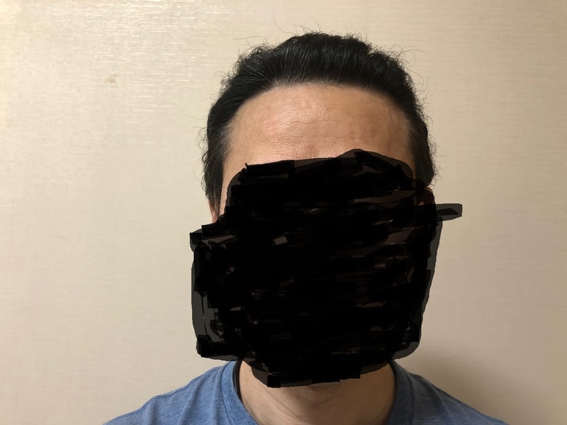 다나 롱헤어 무삭발 7개월