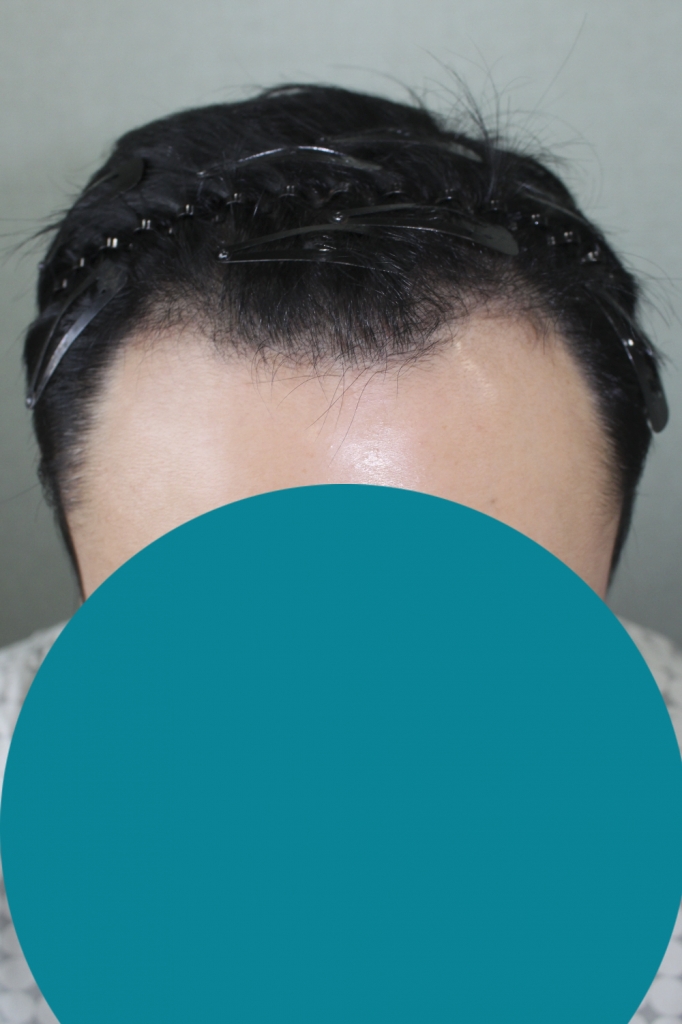 꾸미기_장 원창_20160204_모발_9009.png