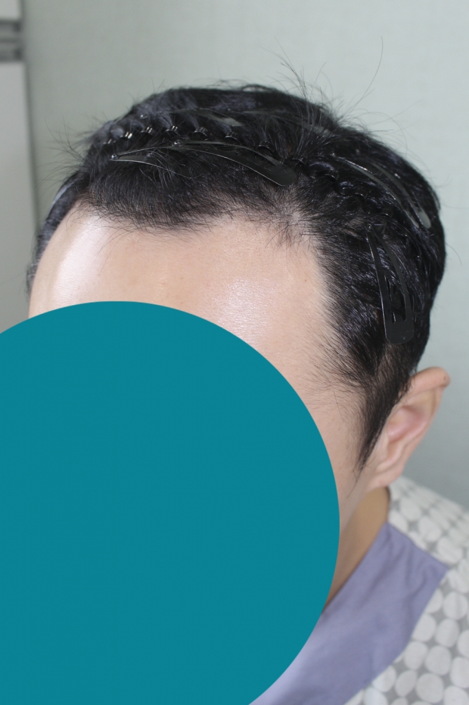 꾸미기_장 원창_20160204_모발_9011.png