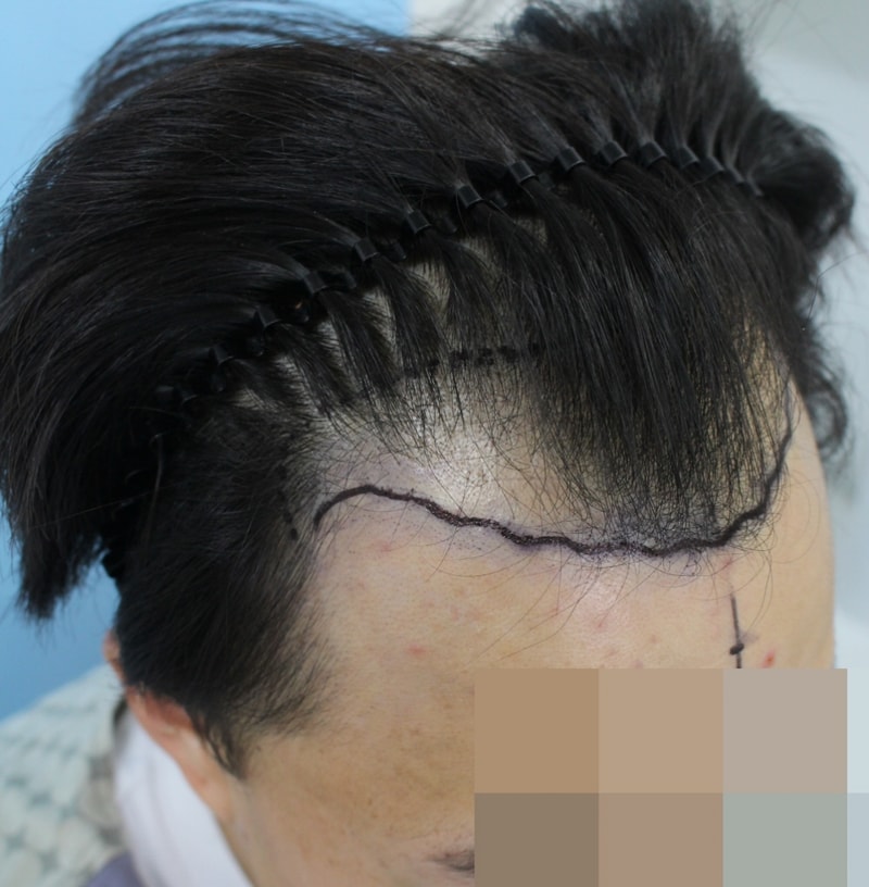 꾸미기_강 호경_20161125_모발_61220.jpg