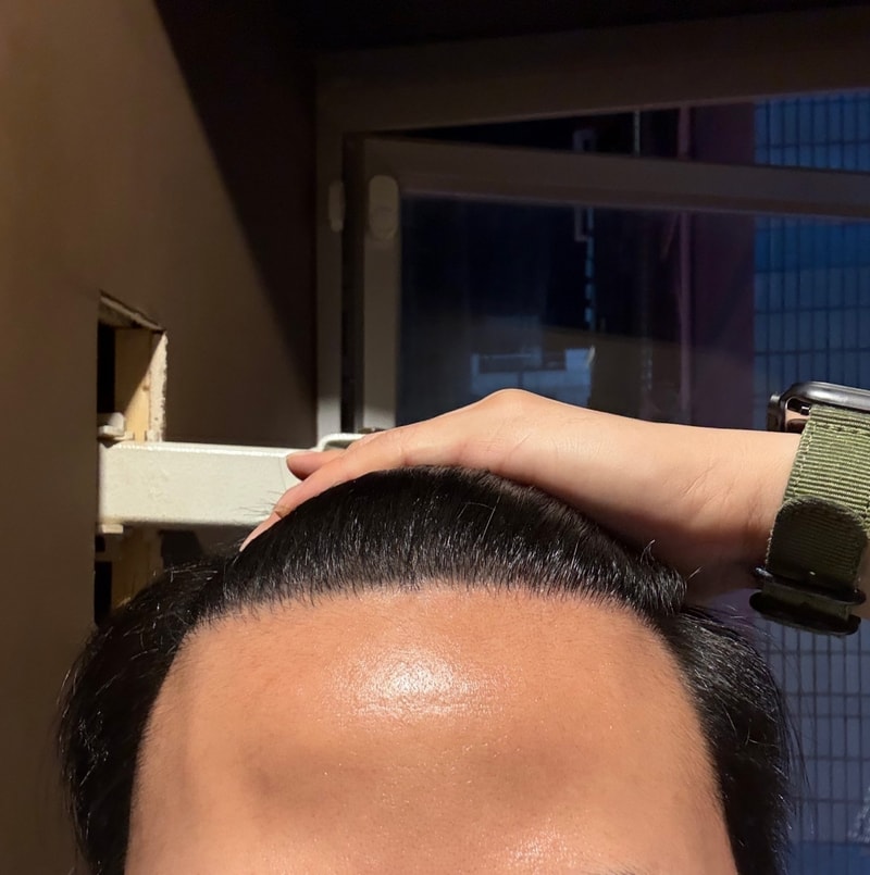 술후2.jpg