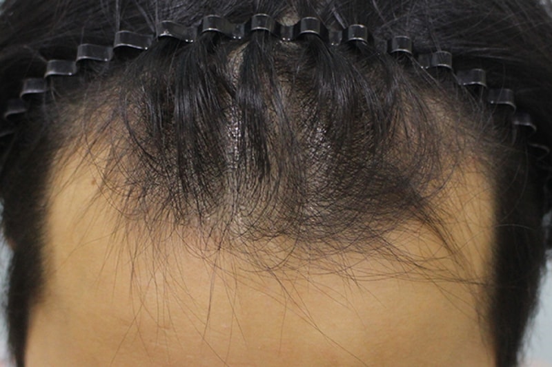 수술전 (3).JPG