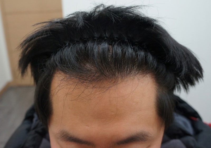 6개월 밀도 부족.jpg