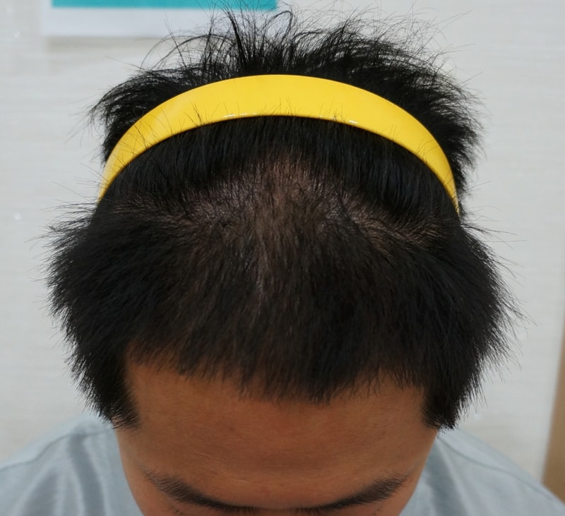 정수리2.jpg