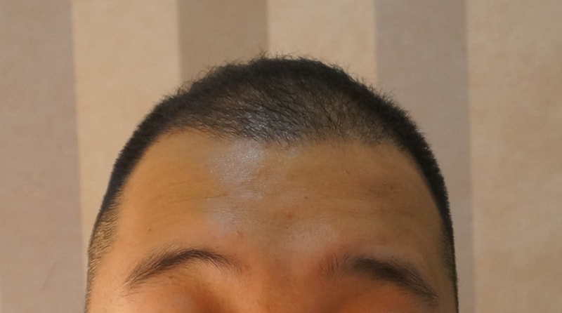 후1.jpg