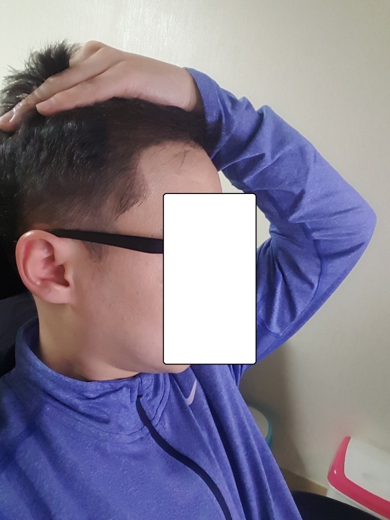 3주 후.jpg
