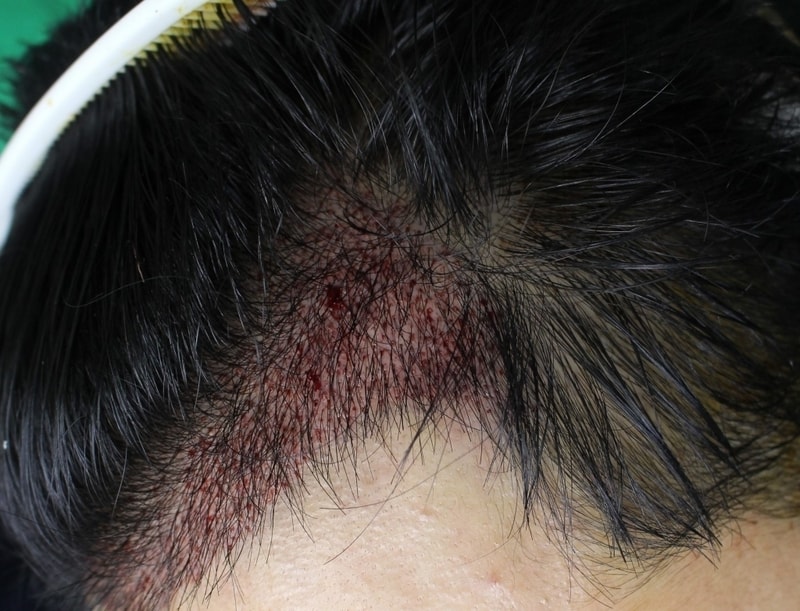 Left view (before).jpg