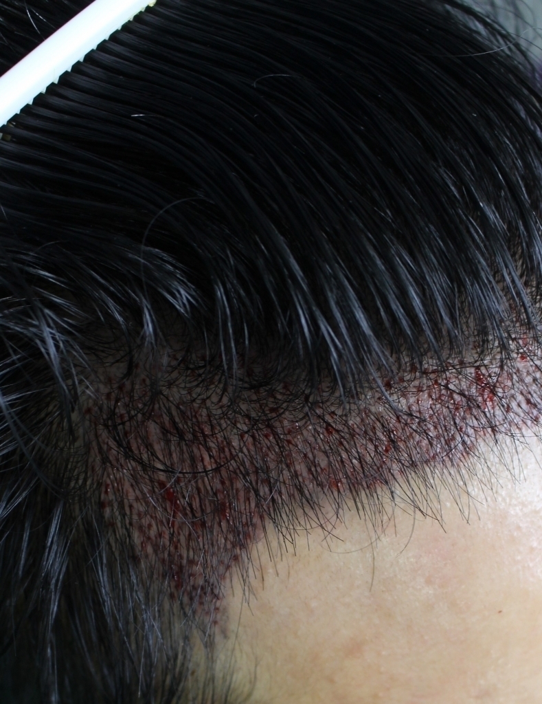 Right view (before).jpg