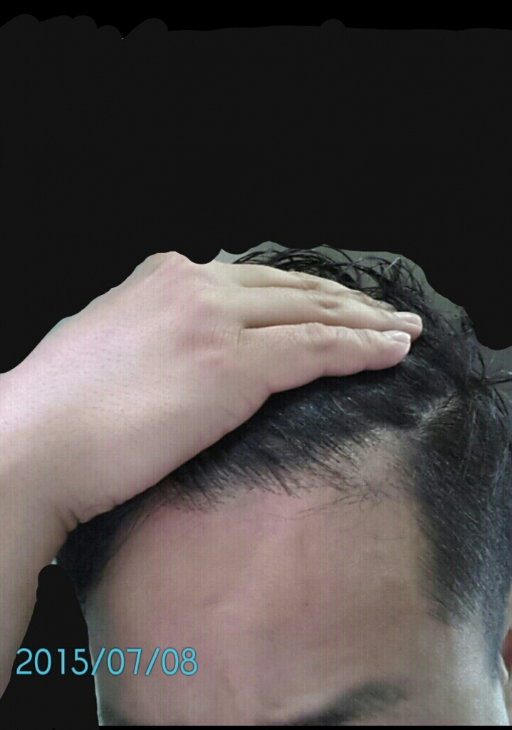 2015-07-08-10-38-13.png