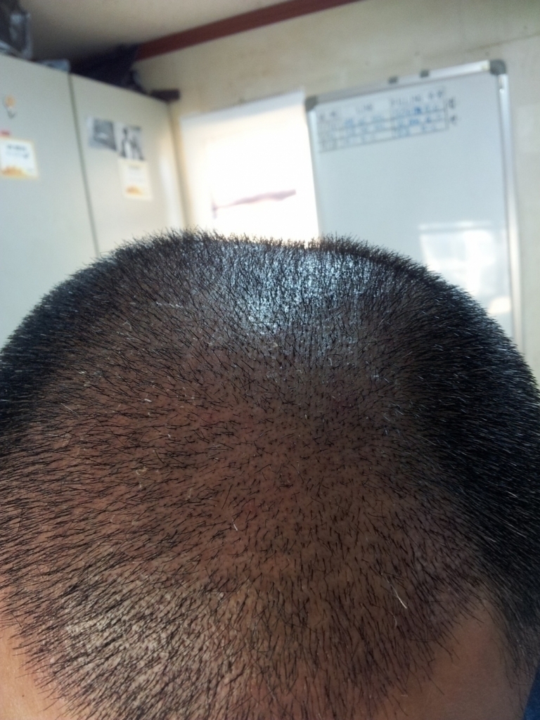 2011-12-14 08.04.35.jpg