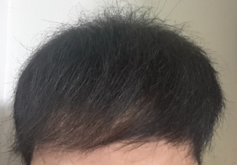 20150824_195851.png