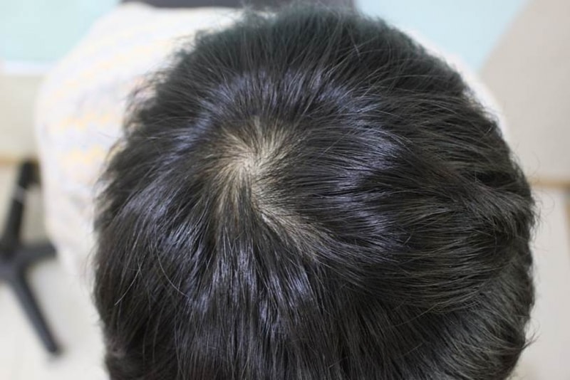 수술전.jpg