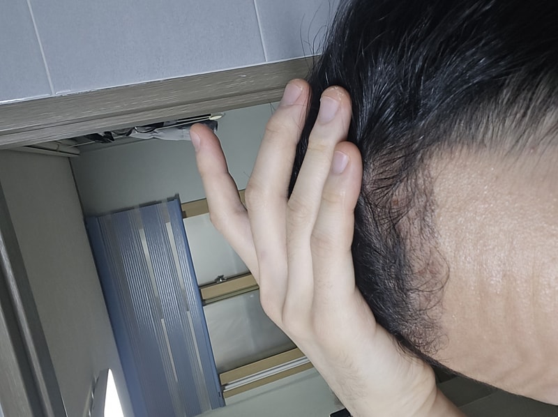 이식3개월4.jpg