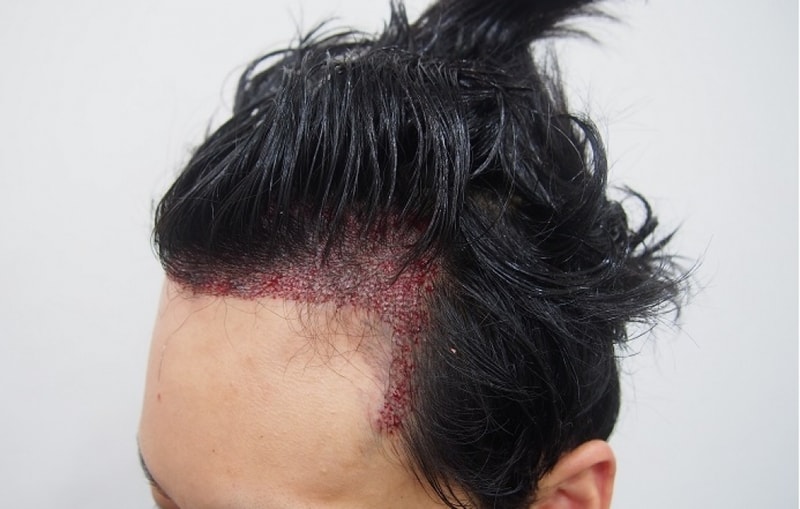 수술후3.jpg