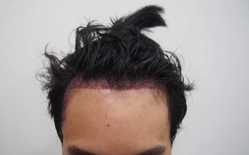 수술후1.jpg
