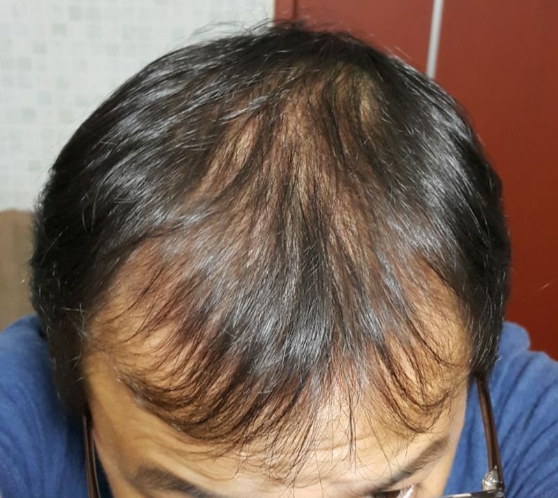 정수리 내리고.JPG