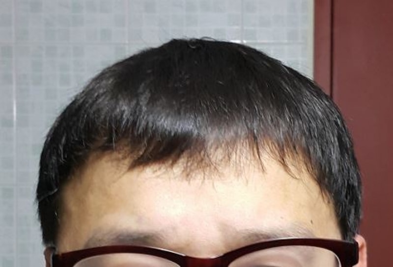 150일 정면.JPG