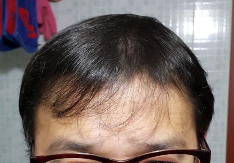120일 정면.JPG