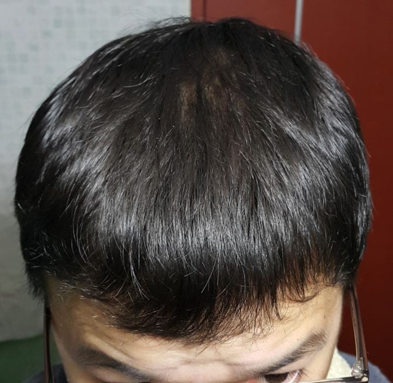 150일 내리고.JPG