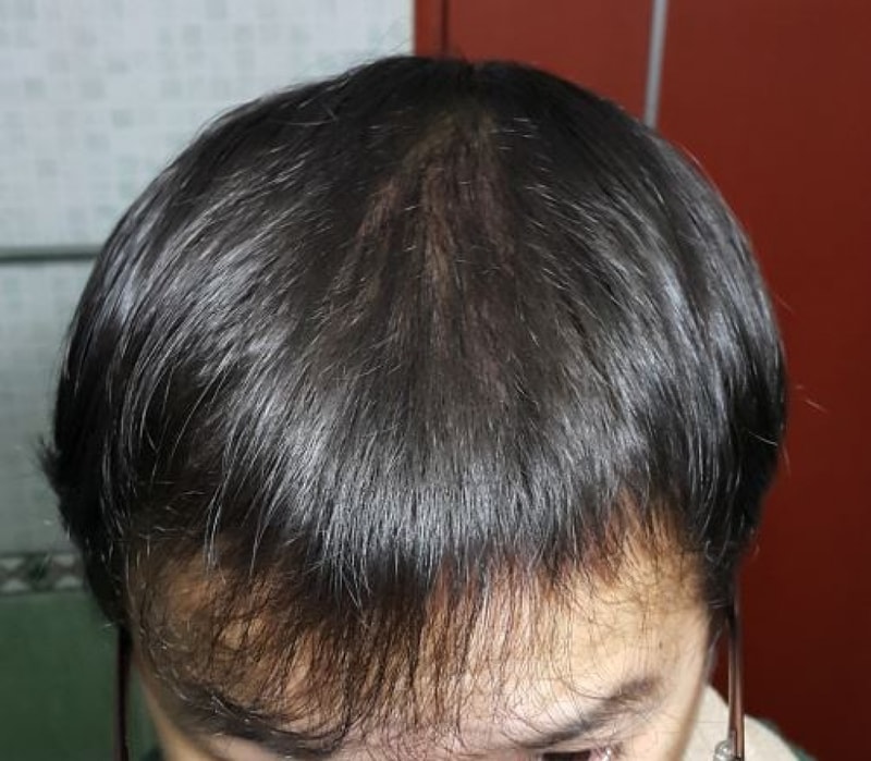 120일 내리고.JPG