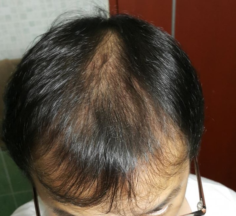 정수리 내리고_60.JPG