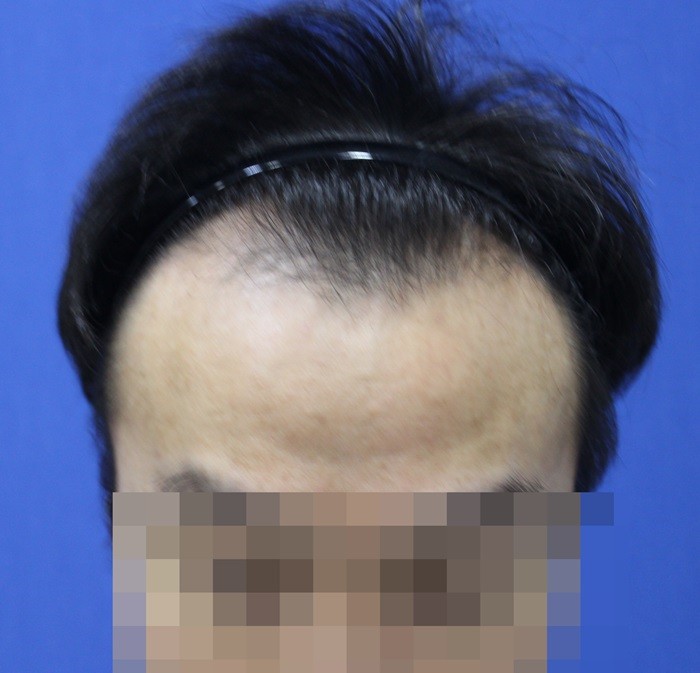 콩콩이다 1.jpg