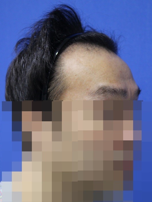 콩콩이다 3.jpg