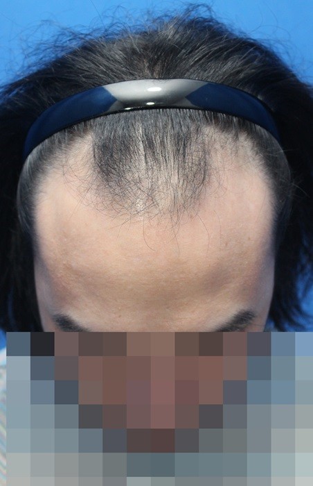1년 8개월 이제 엠자는 안 보입니다