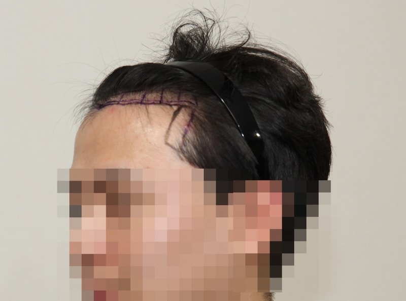 모자이크(02).JPG