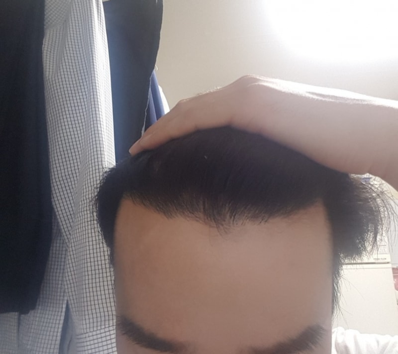 후1.jpg