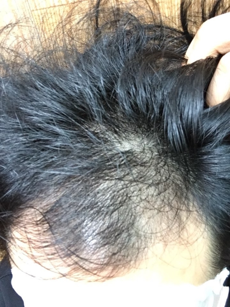 KakaoTalk_20180313_170926129.jpg