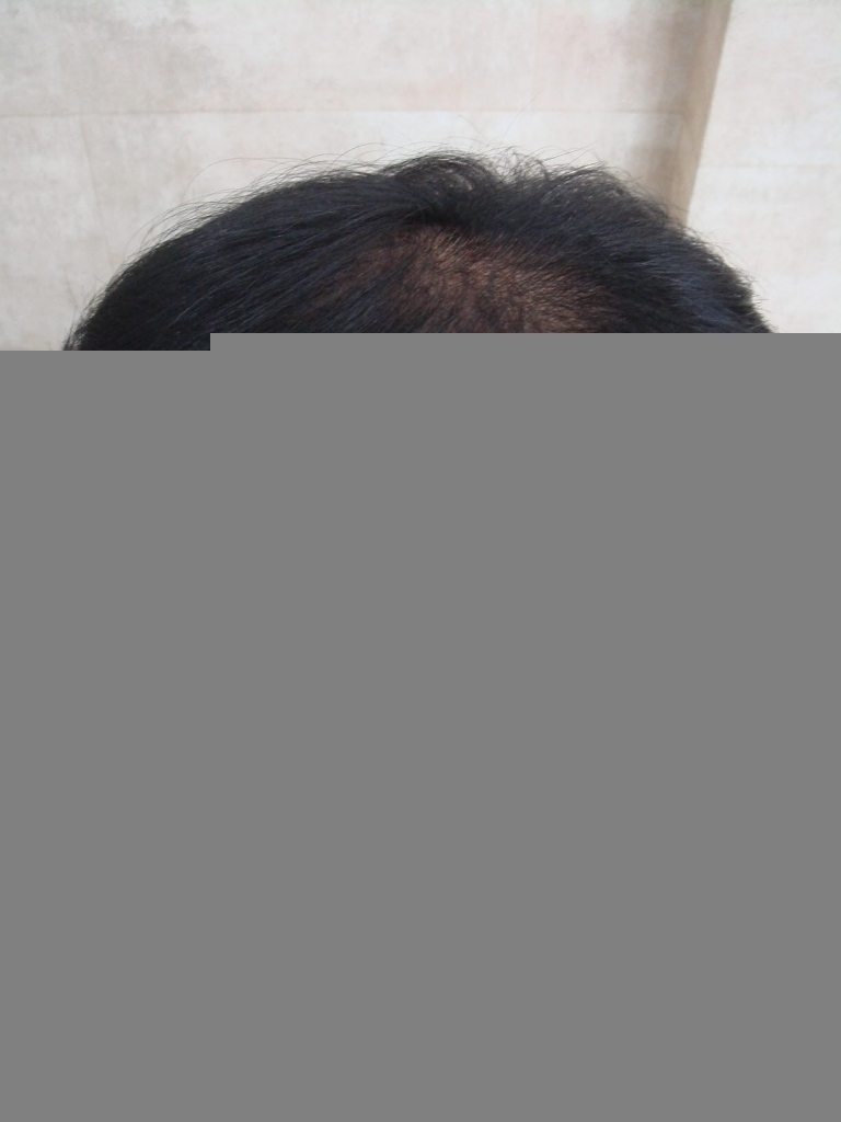20121120_수술전.JPG