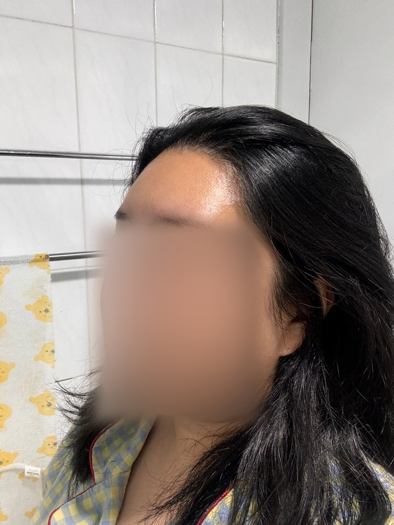 박새봄3개월 모자이크2.jpg