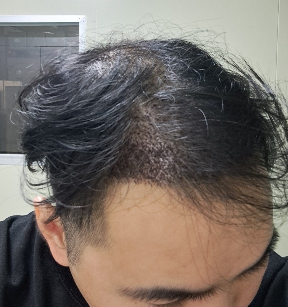 후3.jpg