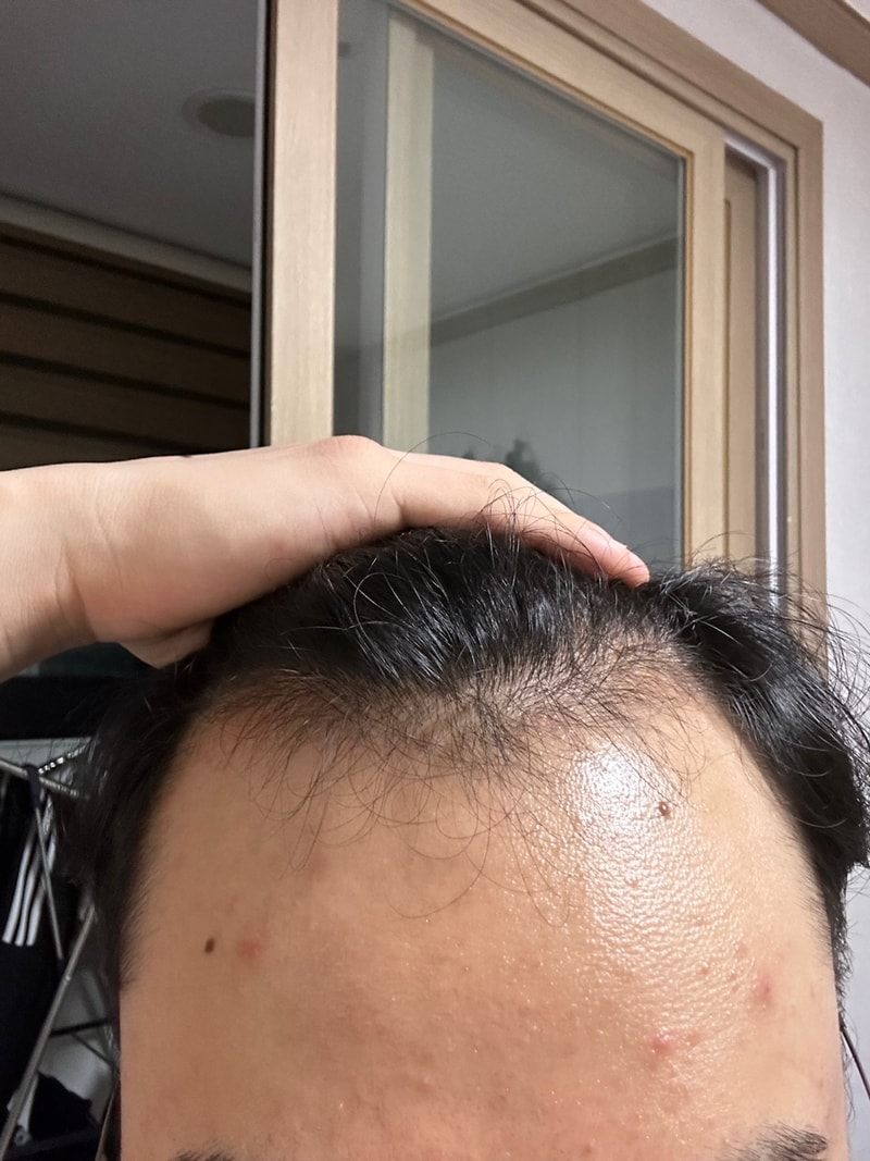 이마.jpg
