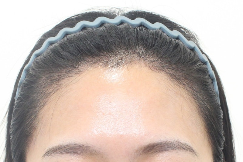 Hairline Non-cut 2300 Mo 3rd Week Review