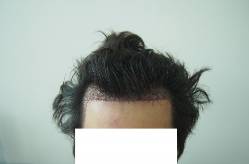 After-정면.JPG