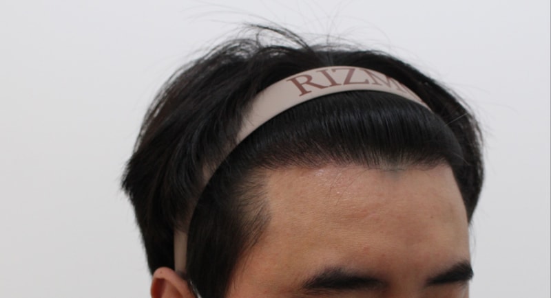 수술 1년차좌.jpg