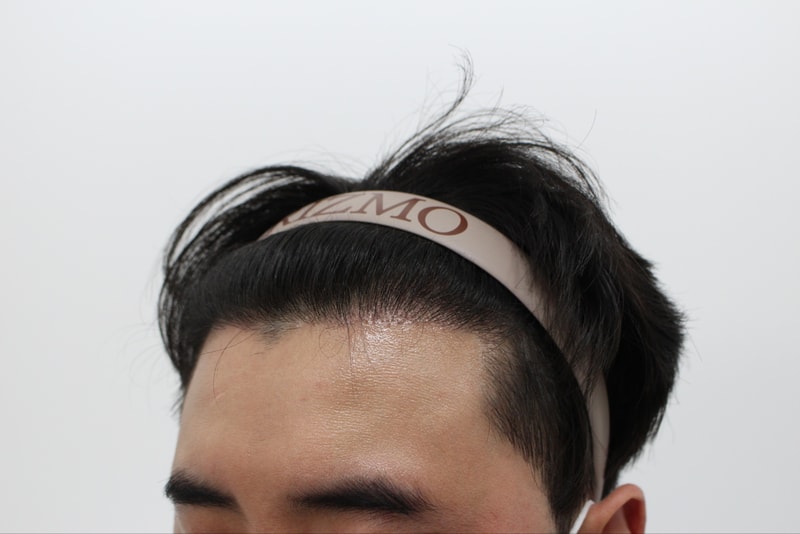 수술 230일차 우.jpg