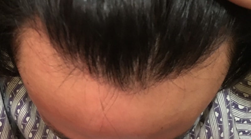 전 정.jpg